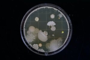 gut bacteria in petri dish for article does alcohol kill gut bacteria